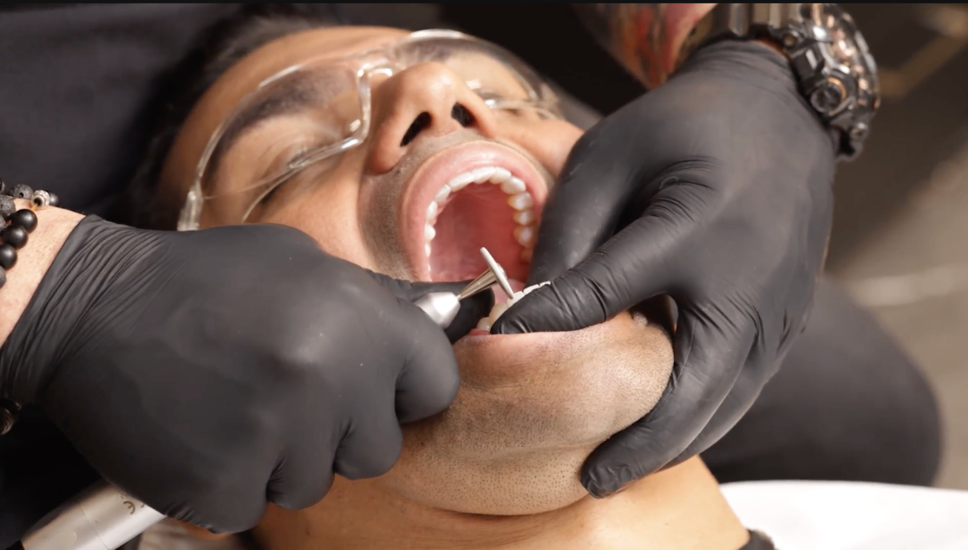 Saiba exatamente o que desgastar, onde e por quê